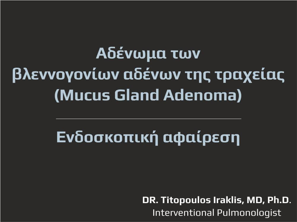Mucus Gland Adenoma